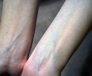 لماذا تبدو عروقنا زرقاء تحت بشرتنا مع ان مايجري داخلها هو دم احمر اللون؟؟