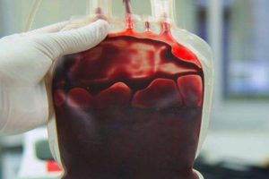 علماء معهد كورتشاتوف يولدون الكهرباء من دم الإنسان تعرف الان