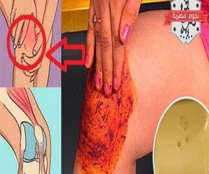 للتخلص من الام الركبة بوصفة طبيعية سهله وبسيطة تحلصك من جميع الام