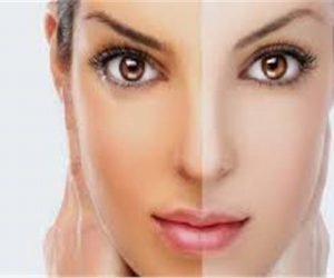 التخلص من اثار الشمس للوجه بمكونات طبيعية وبسيطة الحمص والفول